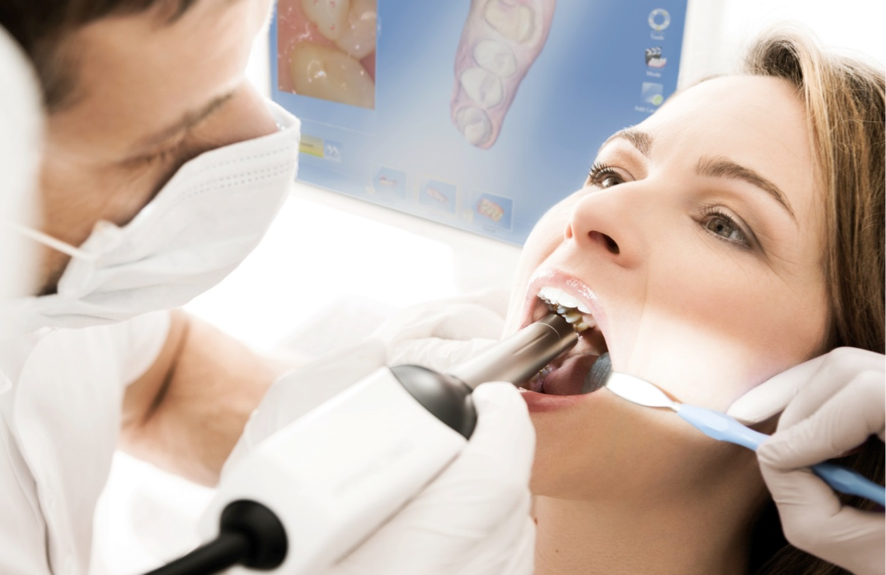 Cerec Cad Cam