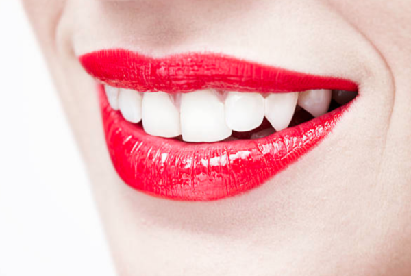 gingivitis y periodontitis