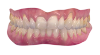Clínica Dental Agulló Vilaró - Dentista de Confianza en Tenerife Sur - escáner 3D SHAPE