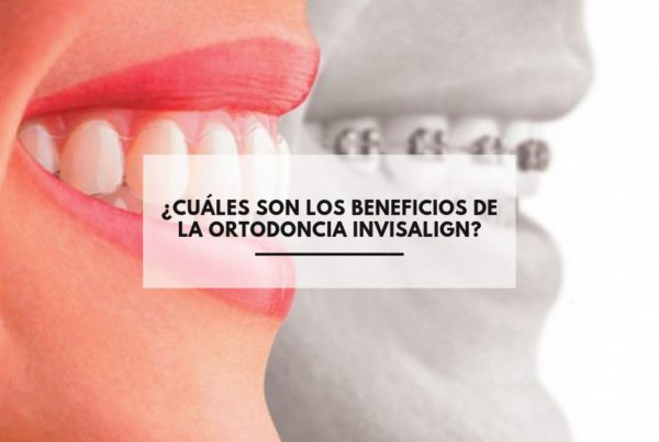 Ortodoncia Invisalign