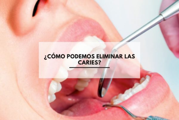 ¿Cómo podemos eliminar las caries?
