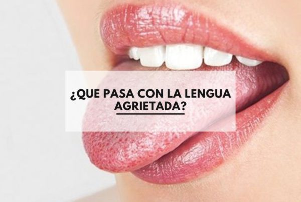 ¿Que pasa con la lengua agrietada?