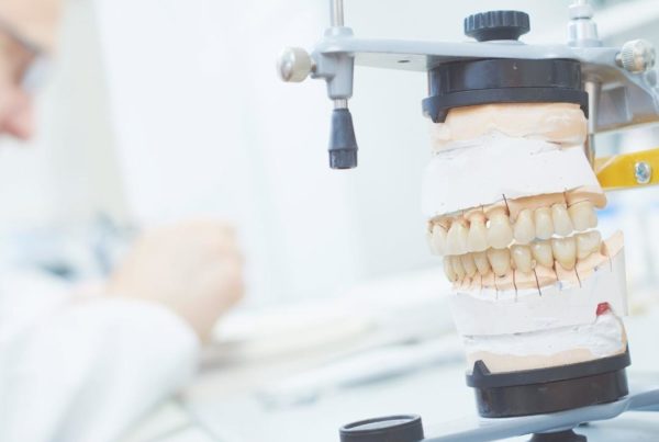 estetica dental